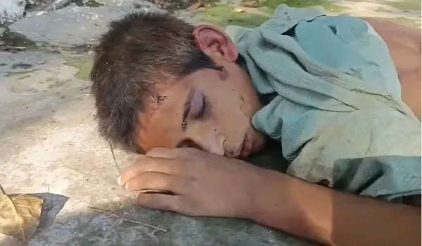 12 साल का मासूम मिला लहूलुहान,  बंधक बनाकर पैरों में घोंपा भाला, सिगरेट से दागा
