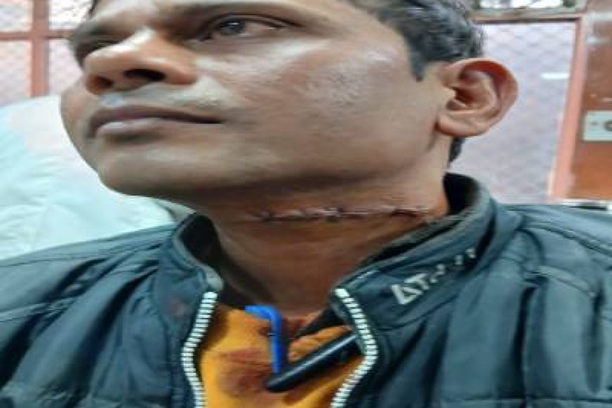 लखनऊ में मांझे से बाइक सवार युवक हुआ गंभीर रूप से घायल